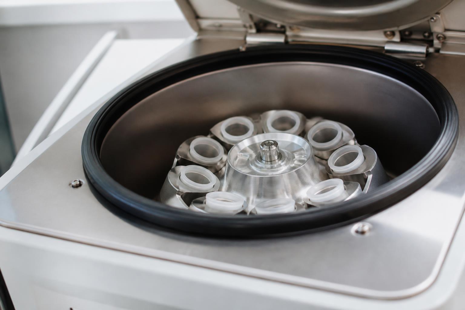 Centrifuge machine used to prepare platelet-rich plasma for PRP treatment